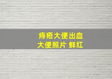 痔疮大便出血大便照片 鲜红